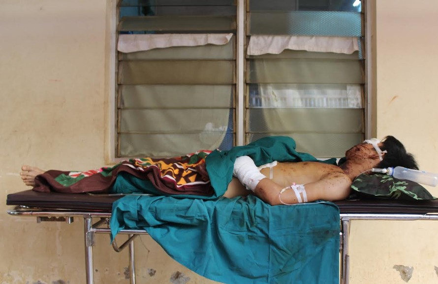 Nạn nhân đang điều trị tại bệnh viện đa khoa tỉnh Đắk Lắk.