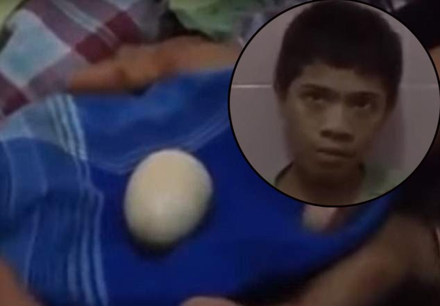 Cậu bé biết "đẻ" trứng ở Indonesia. 