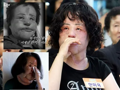 10 thảm họa dao kéo của thế giới
