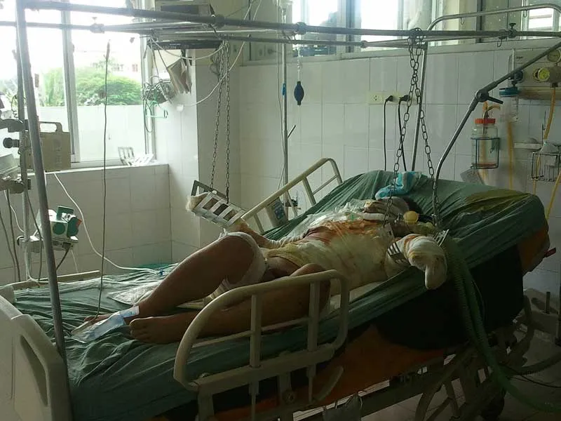 Đổ xăng thiêu cả mình và người yêu vì bị từ chối cưới