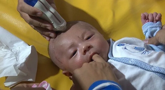 Bé Phát đã qua 2 lần đại phẫu thuật. Ảnh: Khánh Trung.