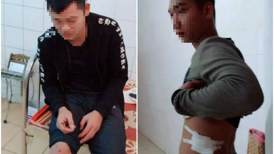 Lái và phụ xe khách Tú Hùng bị côn đồ bắn trọng thương