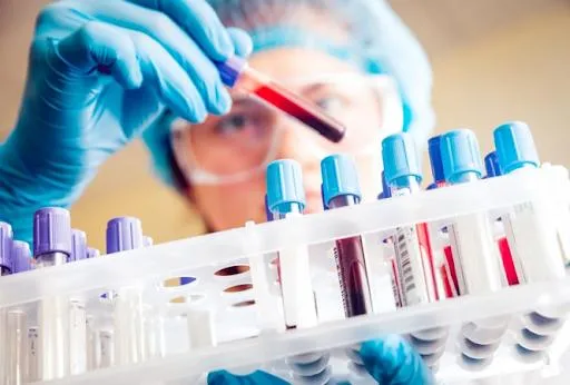 Thần tốc truy vết, khoanh vùng nơi có người mắc COVID-19 (ảnh: HCDC)