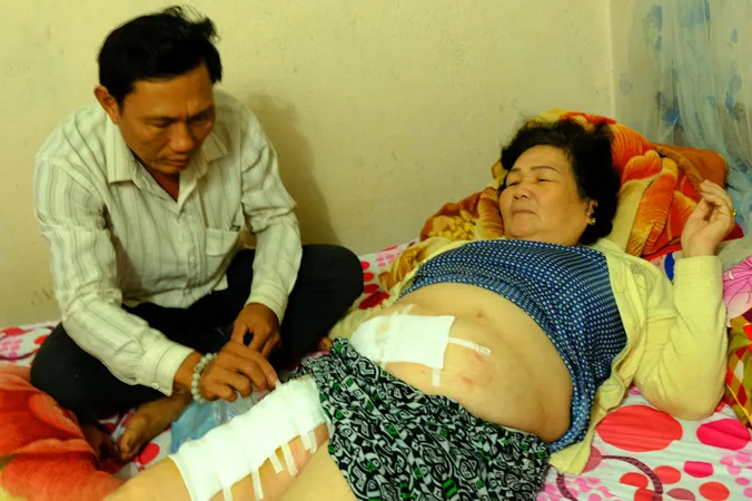 Ông Hùng chăm sóc vết thương cho bà Lan.
