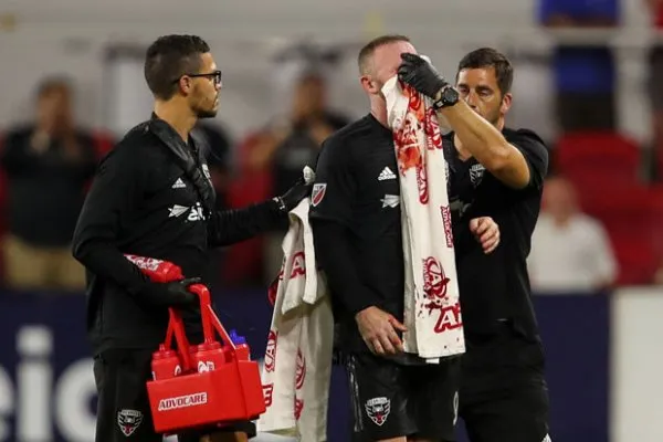 Wayne Rooney vỡ mũi tại Mỹ