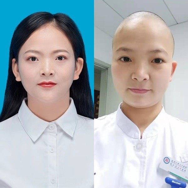 Nữ y tá ở 'tâm bão' Vũ Hán cạo trọc đầu để tránh lây nhiễm chéo virus corona