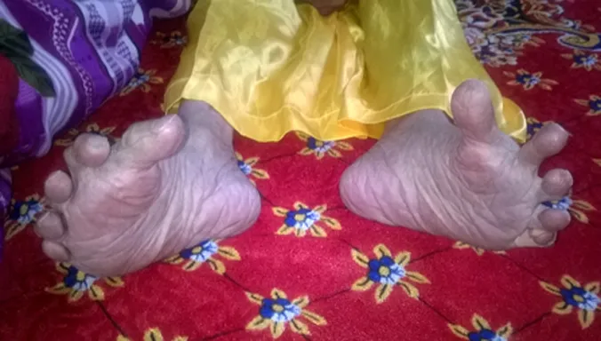 'Bàn chân Giao Chỉ 'của cụ Phương.