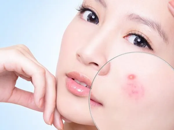 Biết cách đọc vị "đèn pin", bạn sẽ xử lý chúng ngon ơ! 