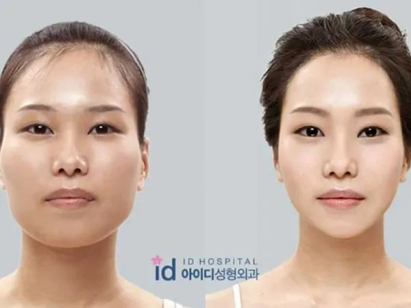 Sau vẻ đẹp lung linh của gái Hàn là nỗi ám ảnh phẫu thuật thẩm mỹ