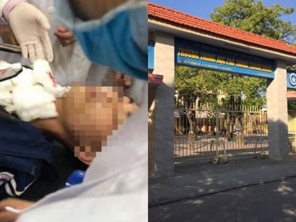 Hải Dương: Học sinh trường THPT Thành Đông bị đâm trọng thương khi tan trường