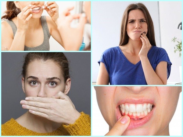 Lười đánh răng dẫn đến những tác hại khôn lường