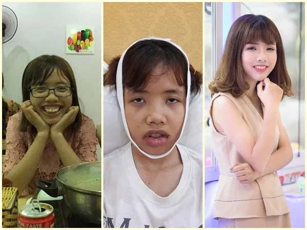 Cô gái bị đuổi việc vì quá xấu, "đập đi xây lại" và cái kết không ngờ
