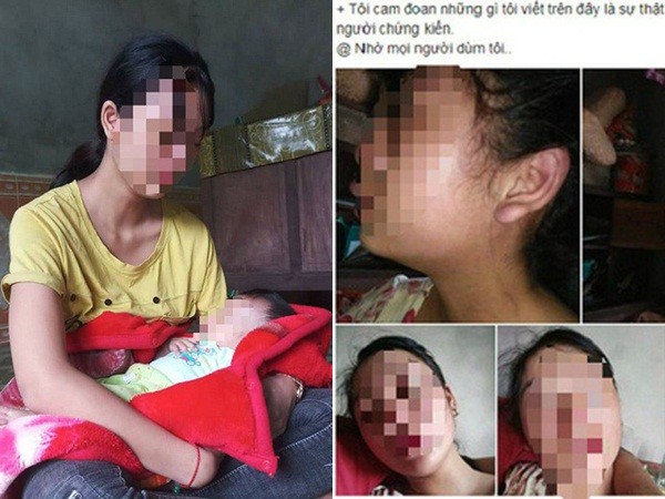 Mẹ trẻ 16 tuổi lên Facebook cầu cứu vì bị chồng bạo hành