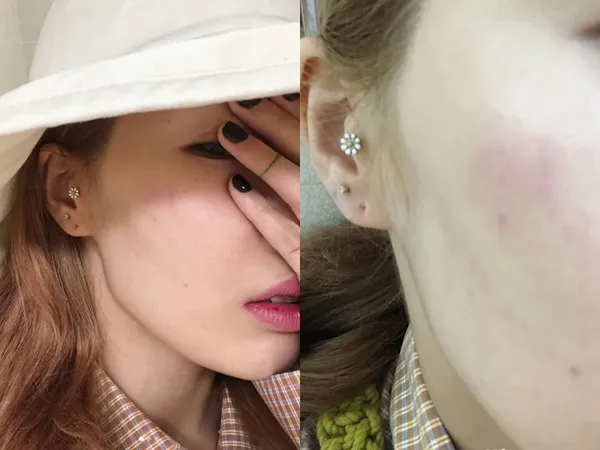 Do sân khấu quá trơn, HyunA gặp tai nạn khi đang biểu diễn tại lễ hội trường học