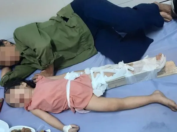 Phụ huynh “tố” học sinh gãy chân tại trường, hiệu trưởng trả lời vô cảm