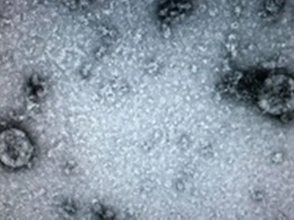 Virus corona có thể sống trong cơ thể một tháng